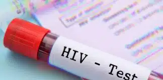 HIV enfeksiyonunun son 10 yılda %460 arttığı tek ülke Türkiye! Hiv Testi