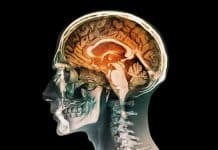 Koku alamama sorunu Parkinson belirtisi olabilir Koku alamama parkinson