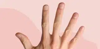 Tırnakların verdiği hastalık belirtileri Tırnakların verdiği hastalık