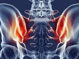 bukalemun hastalığı