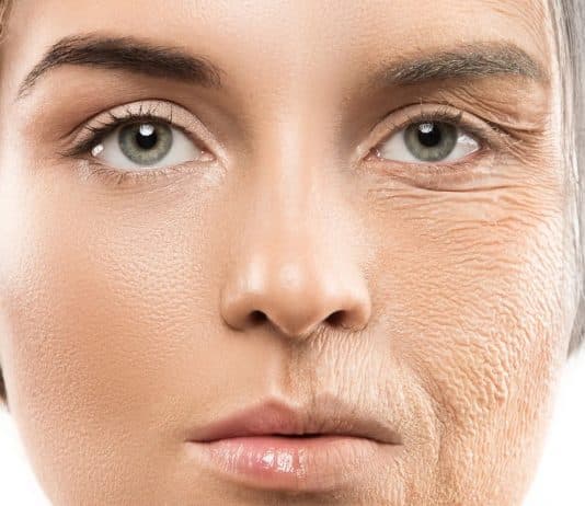 Yaşlanmaya yol açan