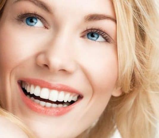 Hollywood gülüşü