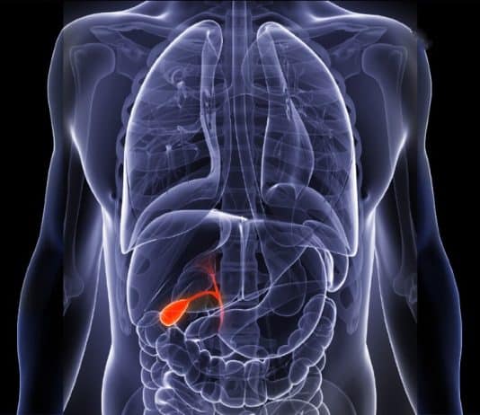 Safra kanalı kanseri