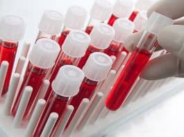 Cinsel yolla bulaşan