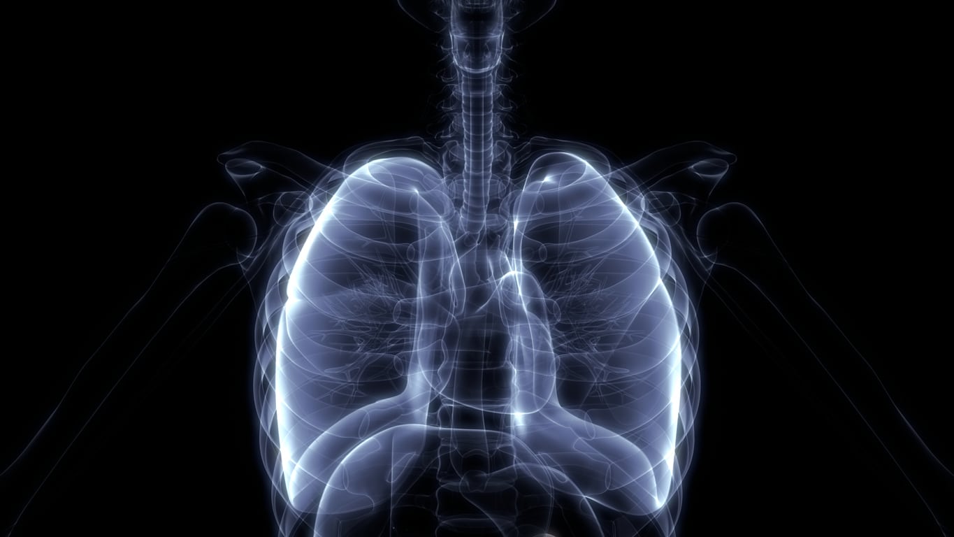 Akciğer sertleşmesi