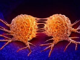 meme kanseri vücutta