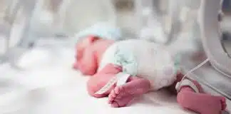 Prematüre bebek bakımının yolları Prematüre bebek