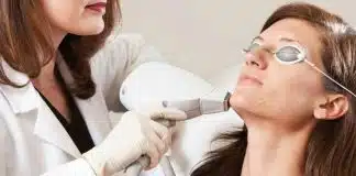 Cilt lekelerinden kurtulmak için ne yapmalı? Lazer tedavisi etkili mi? cilt lekeleri lazer