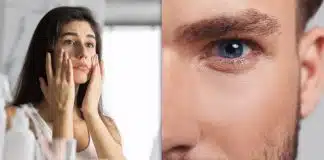 En sık görülen 5 cilt sorunu ve çözümü cilt sorunu