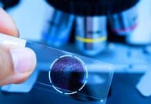 Frozen yöntemi nedir? 15 dakikada kanser teşhisi! Frozen yöntemi