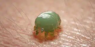 Uyuz salgını: Sebebi hayvanlar değil, alışveriş! uyuz hastalığı
