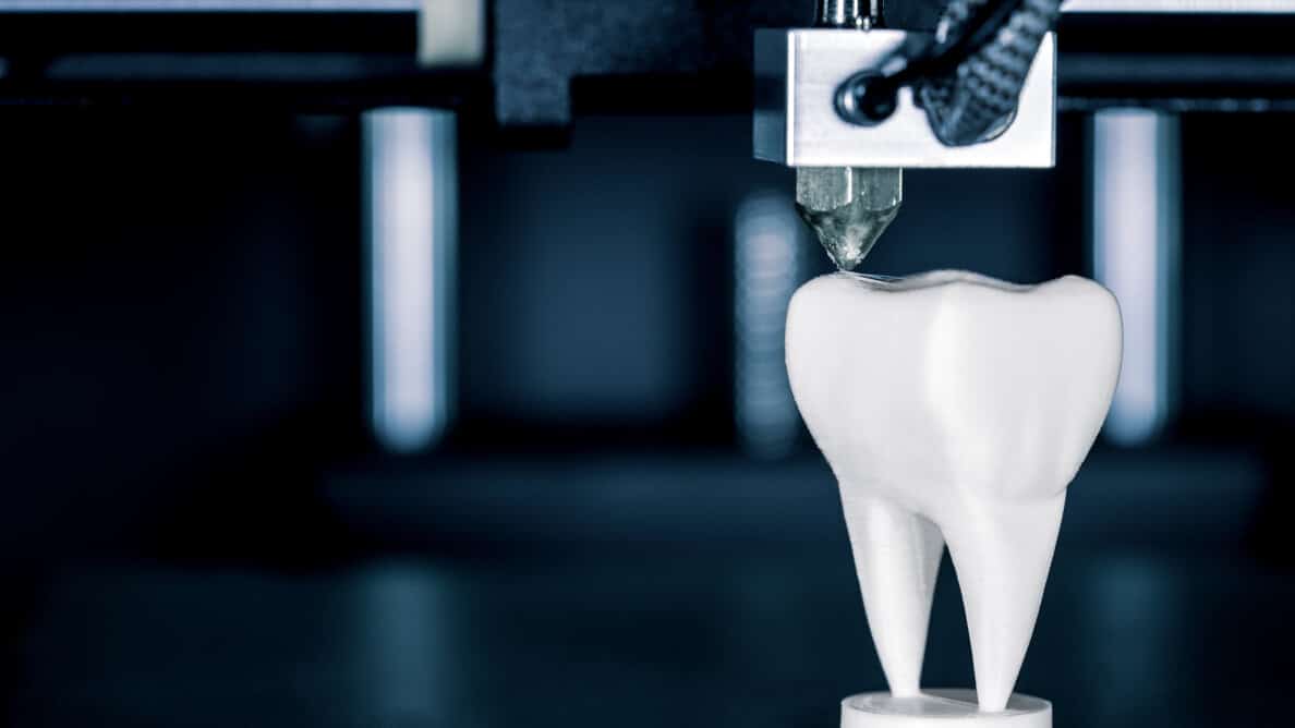 3D Baskı implant
