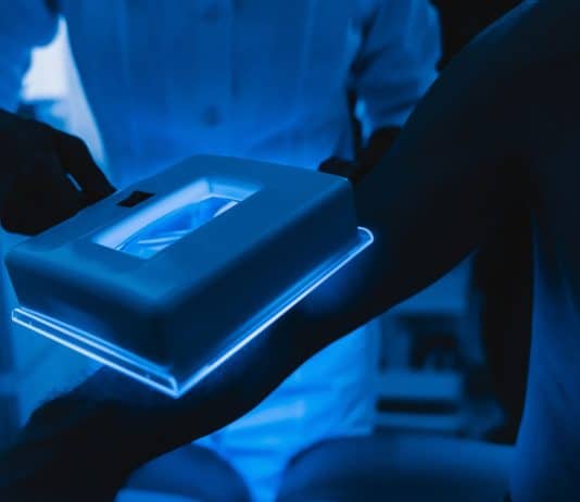 Cilt lekesi tedavisi