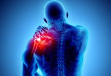 Rotator manşet yırtığı nedir? Belirtileri neler? Rotator manşet yırtığı