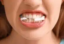 Çene eklem bozukluğu