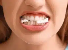 Çene eklem bozukluğu