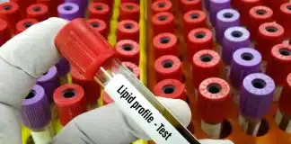 HDL ve LDL: Kolesterolünüz iyi huylu mu, kötü huylu mu? hdl ldl kolesterol