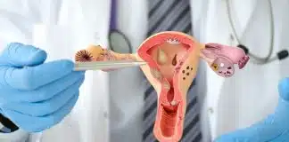 kadın hastalıkları