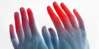 Reyno hastalığı nedir? Nasıl belirti verir? Reyno hastalığı nedir