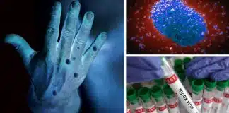M-Pox (Maymun Çiçeği) nasıl bir virüs? Pandemi ihtimali var mı? mpox Maymun Çiçeği