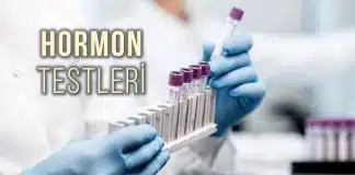 Menopoz hormon testleri neden yapılır? Menopoz hormon testleri