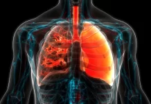 akciğer Pulmoner hipertansiyon