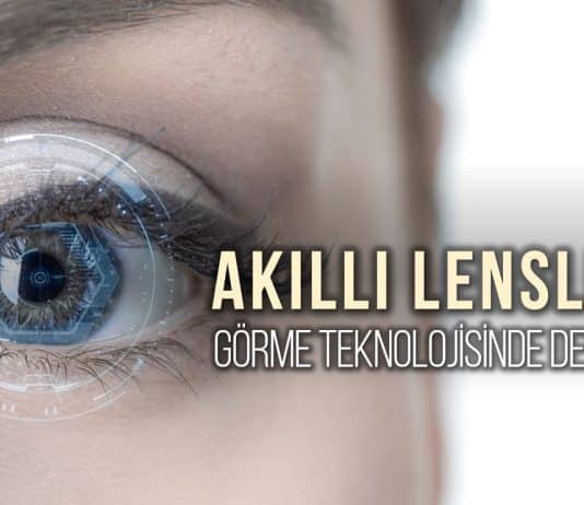 göz içi lensler