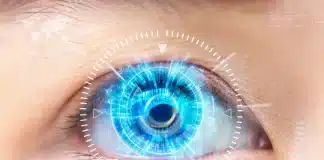 Katarakt mercek lens