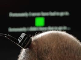 beyin implantı