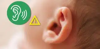 Bebeklerde işitme kaybı nasıl anlaşılır? Erken belirtileri neler? Bebeklerde işitme kaybı