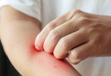 Egzama için dermatolog