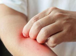 Egzama için dermatolog