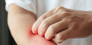 Egzama için dermatolog