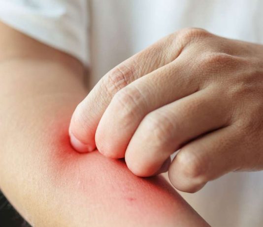 Egzama için dermatolog