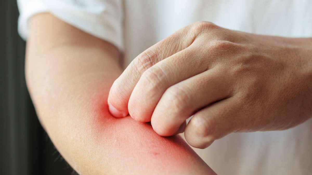 Egzama için dermatolog