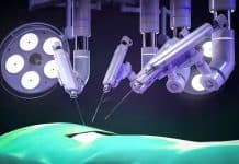 srt-h robot ameliyat