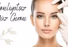 ameliyatsız yüz germe