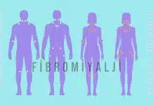 Fibromiyaljiye ne iyi gelir