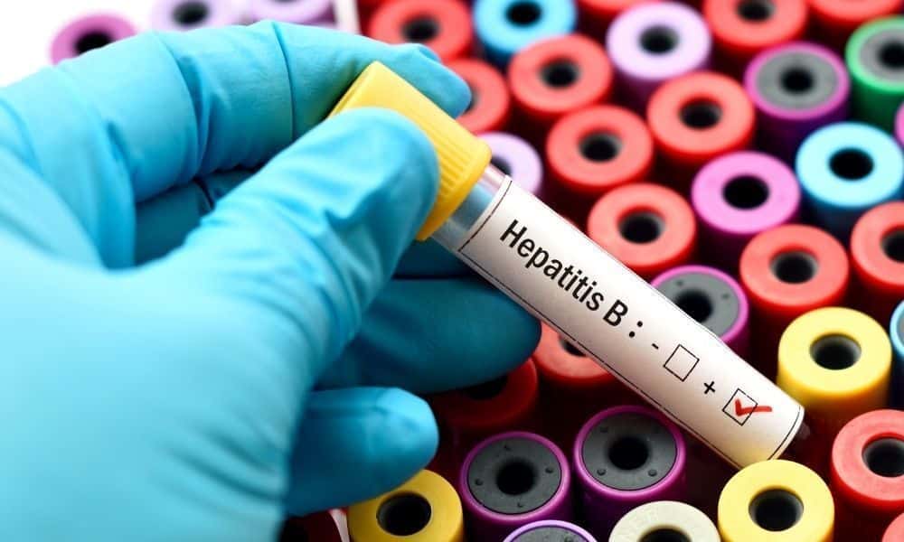 hepatit belirtileri ve korunma yolları