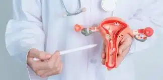 Miyomlar kansere dönüşür mü? 10 soruda miyom gerçeği Miyomlar