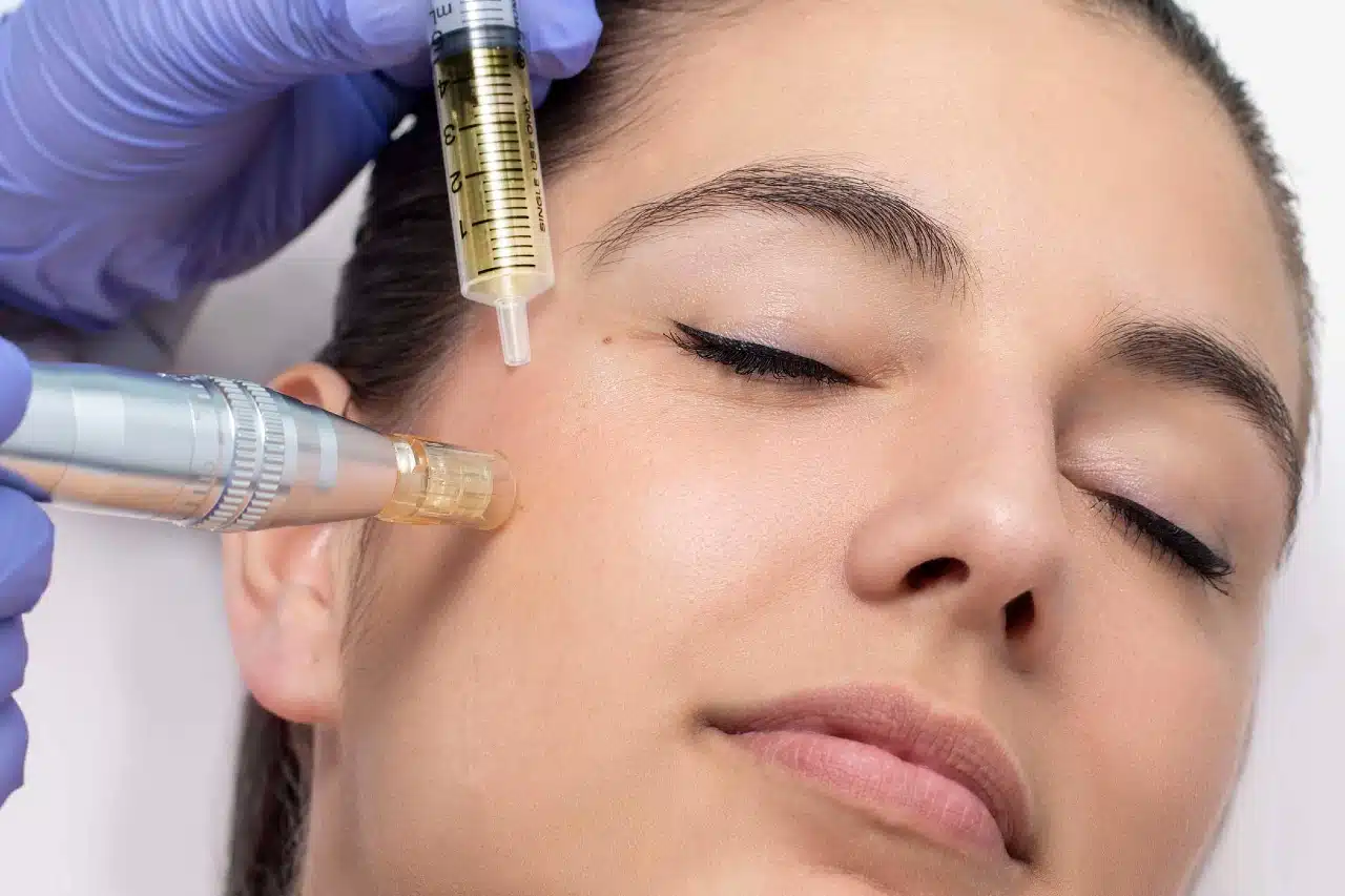 ⚖️ Altın iğne vs. lazer vs. geleneksel dermapen: Hangi yöntem daha etkili?