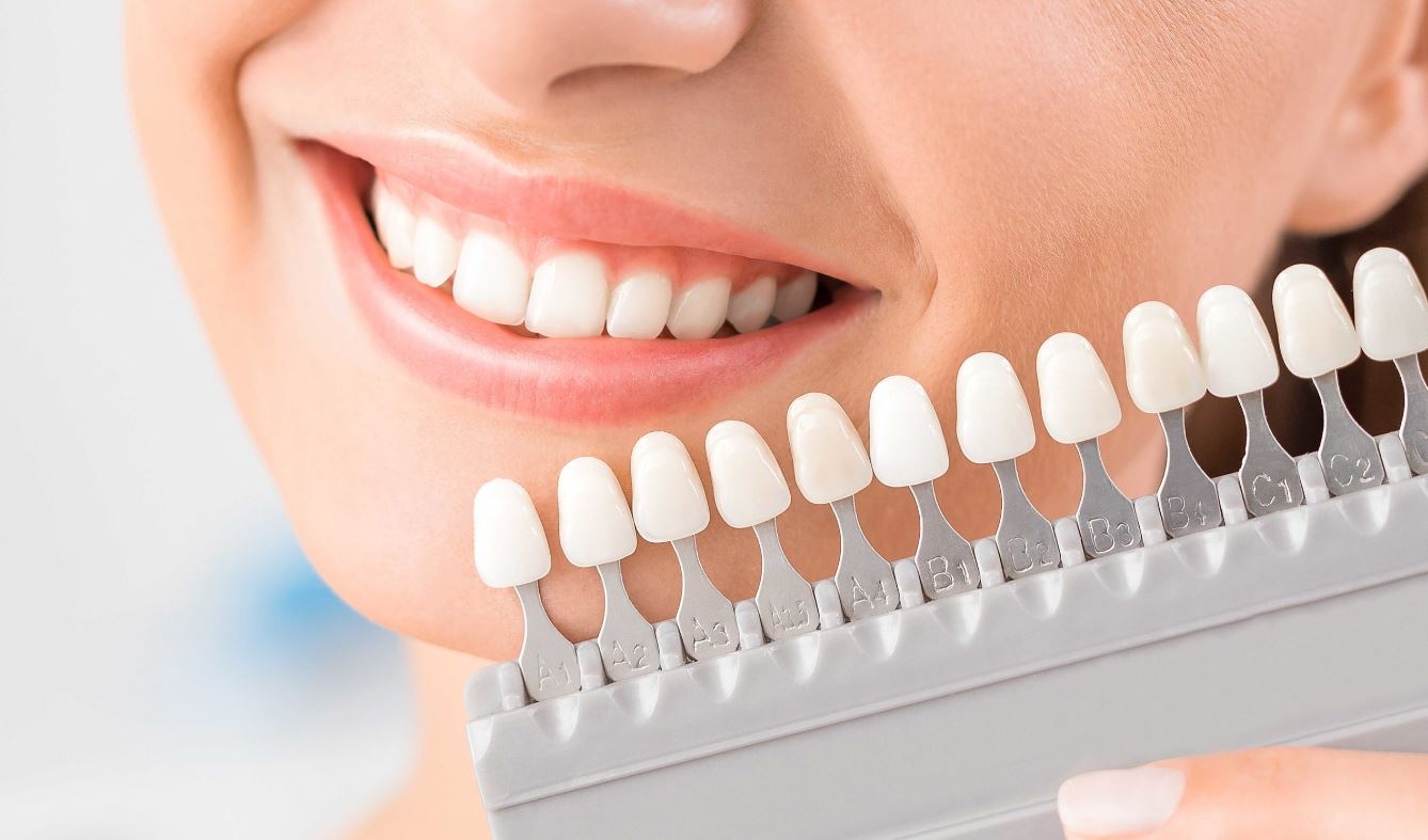 Farklı diş rengi tonları, dişlerde sararma nedenleri ve tek bir dişte kararma gibi durumların profesyonel diş beyazlatma ile çözümü.