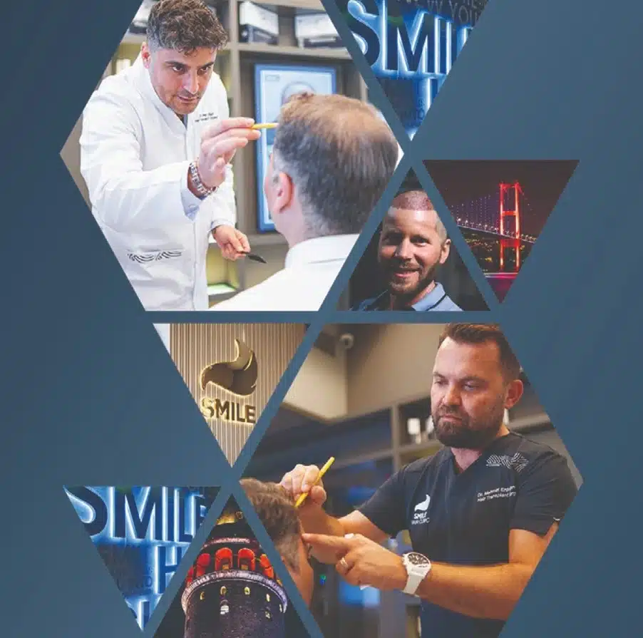 En iyi saç ekimi kliniği için klinik seçimi yaparken Smile Hair Clinic, DHI saç ekimi tekniği ve saç ekimi bütçesi değerlendirilir.