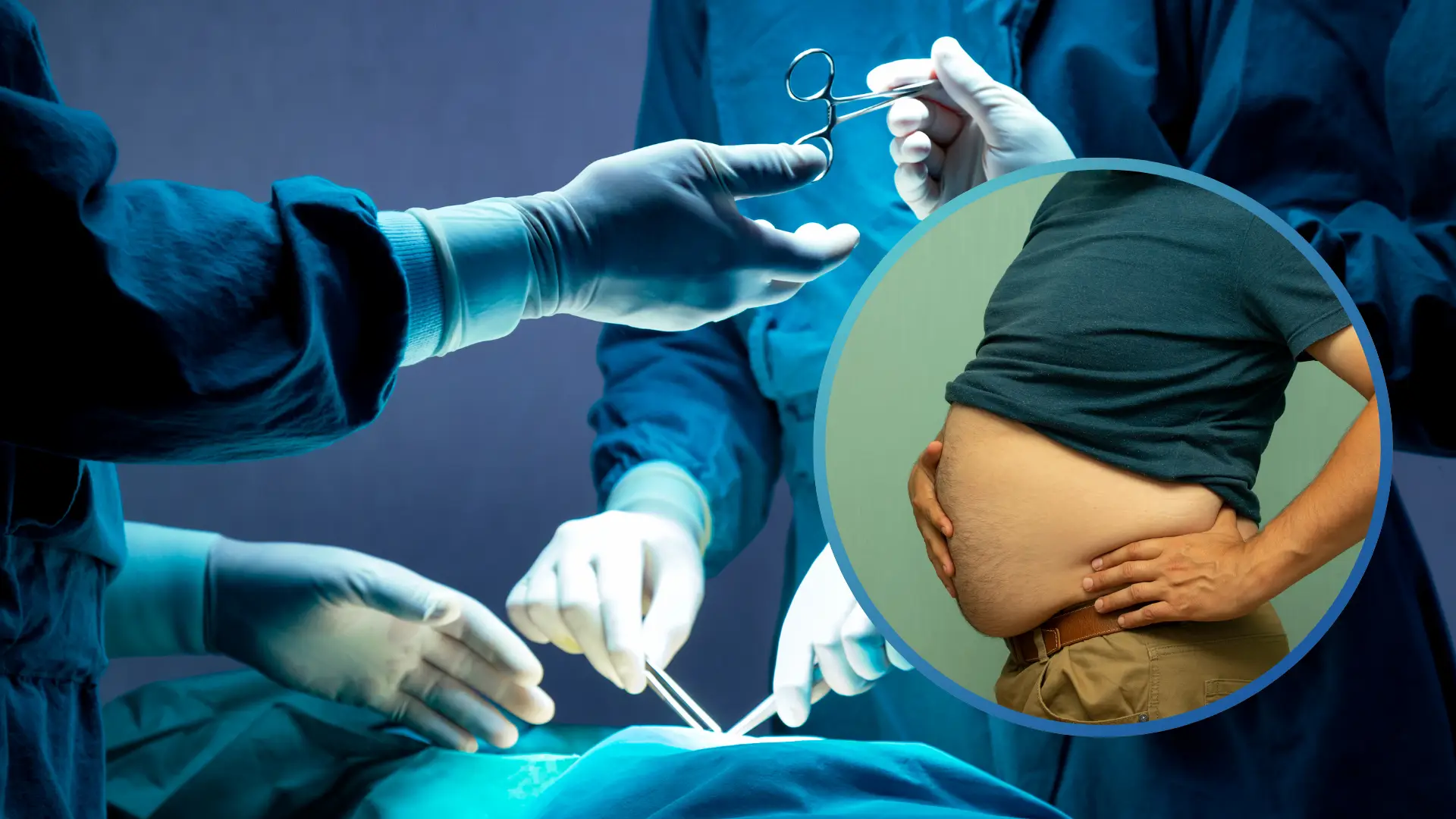Obezite cerrahisi sonrası vücut kitle indeksi değişimi, tüp mide ameliyatı ve tip 2 diyabet üzerindeki olumlu etkileri.
