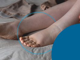 vücutta ödem belirtileri ve ödem söktürücü öneriler