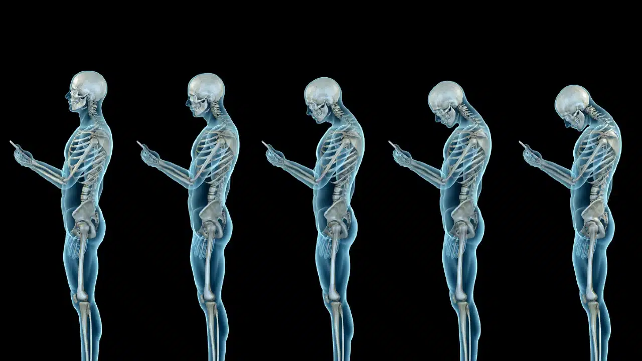 "Tech neck" nedir? Sürekli ekrana bakmanın yol açtığı 5 tehlike