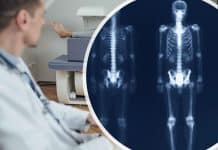 Osteoporoz teşhisinde DEXA testi: Kemik erimesi ölçümü ve T-skoru