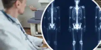 Osteoporoz teşhisinde DEXA testi: Kemik erimesi ölçümü ve T-skoru Osteoporoz teşhisinde DEXA testi: Kemik erimesi ölçümü ve T-skoru