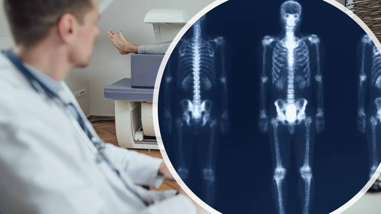 Osteoporoz teşhisinde DEXA testi: Kemik erimesi ölçümü ve T-skoru