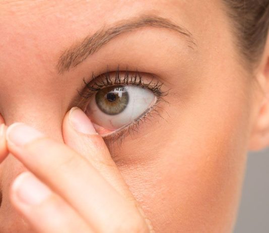 Göz alerjisi ve belirtileri: Göz kaşıntısı, alerjik konjonktivit ve kontakt lens kullanıcıları için riskler.